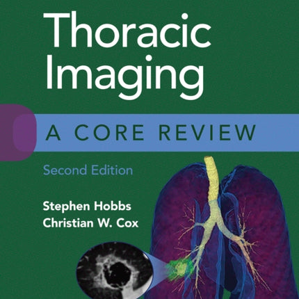 Thoracic Imaging: A Core Review