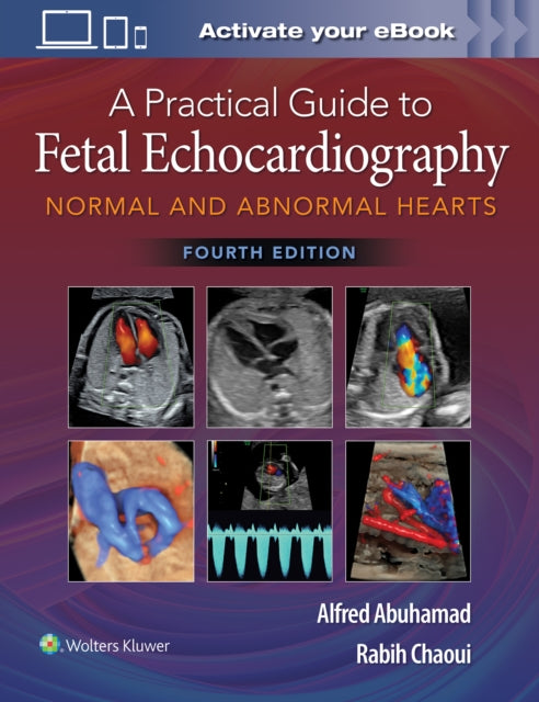 A Practical Guide to Fetal Echocardiography: Normal and Abnormal Hearts