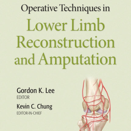 Operative Techniques in Lower Limb  Reconstruction and Amputation