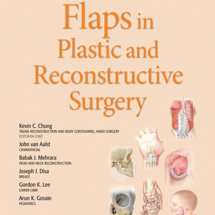 Flaps in Plastic and Reconstructive Surgery