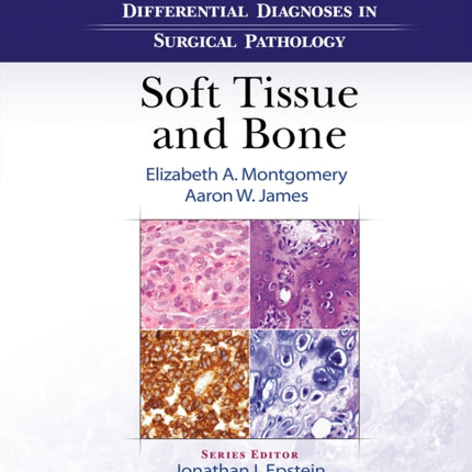 Differential Diagnoses in Surgical Pathology: Soft Tissue and Bone