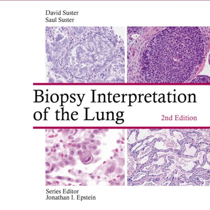 Biopsy Interpretation of the Lung