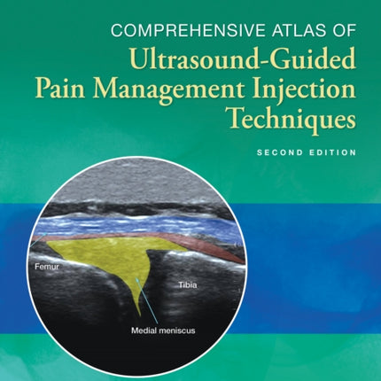 Comprehensive Atlas of Ultrasound-Guided Pain Management Injection Techniques