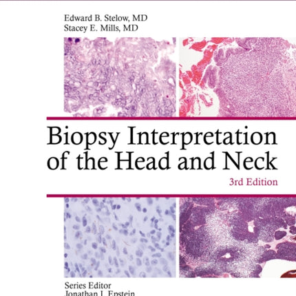 Biopsy Interpretation of the Head and Neck