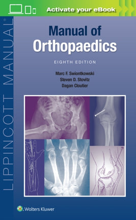 Manual of Orthopaedics