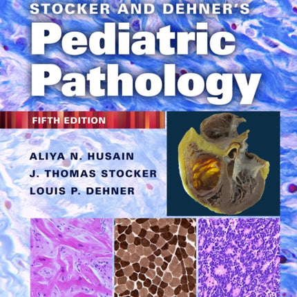 Stocker and Dehner's Pediatric Pathology