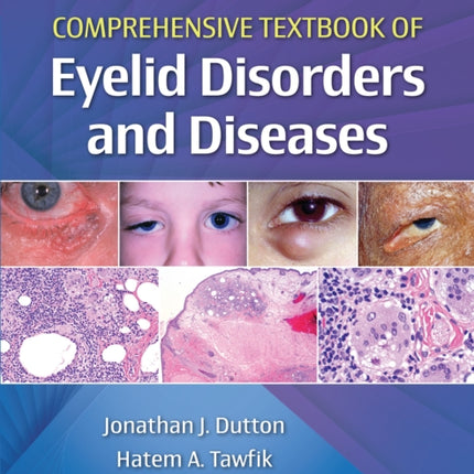 Comprehensive Textbook of Eyelid Disorders and Diseases