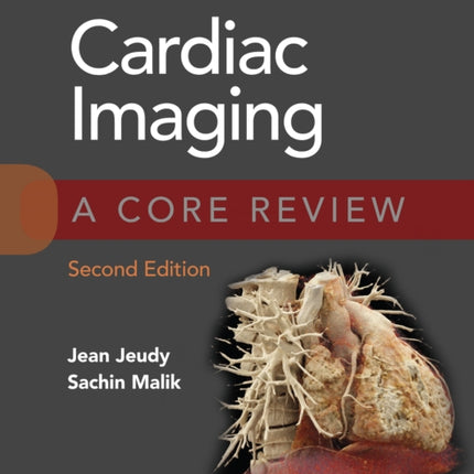 Cardiac Imaging: A Core Review