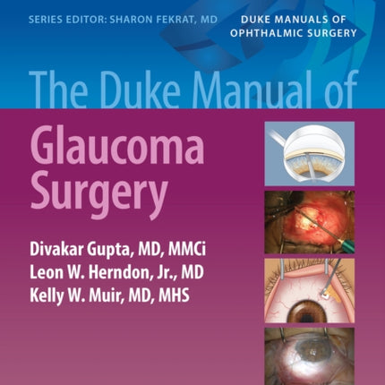 The Duke Manual of Glaucoma Surgery