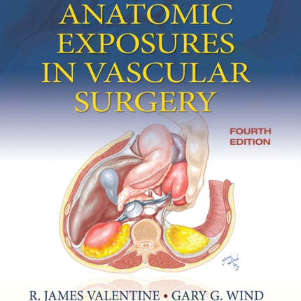 Anatomic Exposures in Vascular Surgery