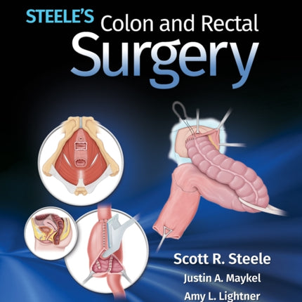 Steele's Colon and Rectal Surgery