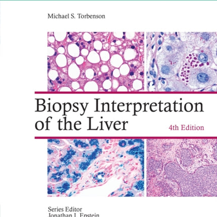 Biopsy Interpretation of the Liver