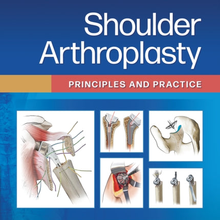 Shoulder Arthroplasty: Principles and Practice