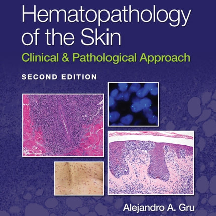 Hematopathology of the Skin: Clinical & Pathological Approach