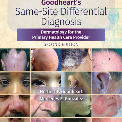 Goodheart's Same-Site Differential Diagnosis: Dermatology for the Primary Health Care Provider