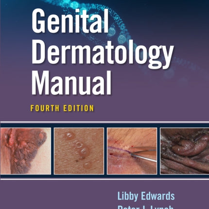 Genital Dermatology  Manual