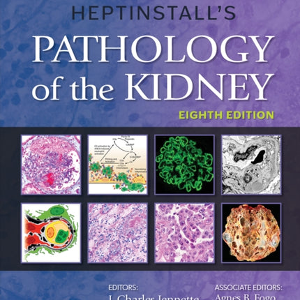 Heptinstall's Pathology of the Kidney