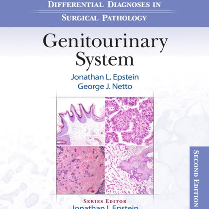 Differential Diagnoses in Surgical Pathology: Genitourinary System