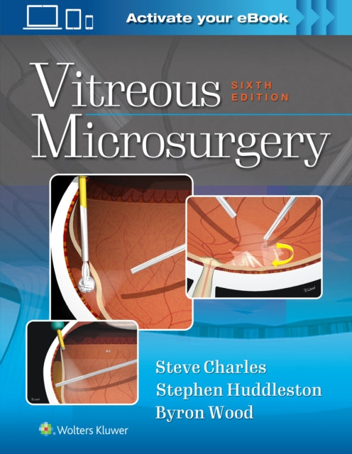 Vitreous Microsurgery