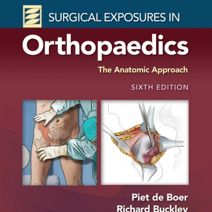 Surgical Exposures in Orthopaedics: The Anatomic Approach