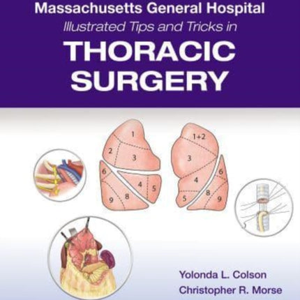 Massachusetts General Hospital Illustrated Tips and Tricks in Thoracic Surgery