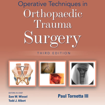 Operative Techniques in Orthopaedic Trauma Surgery