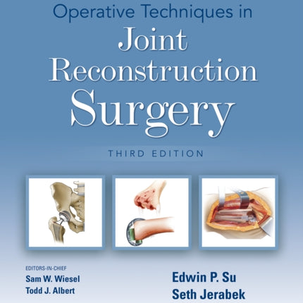 Operative Techniques in Joint Reconstruction Surgery