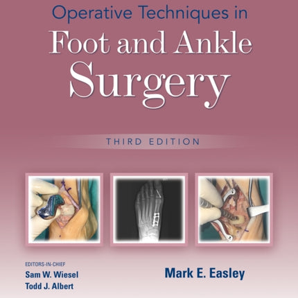 Operative Techniques in Foot and Ankle Surgery