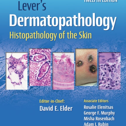 Lever's Dermatopathology: Histopathology of the Skin