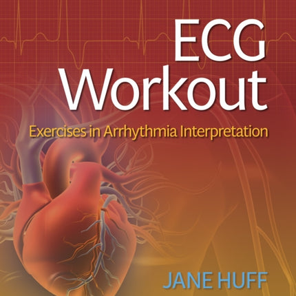 ECG Workout: Exercises in Arrhythmia Interpretation