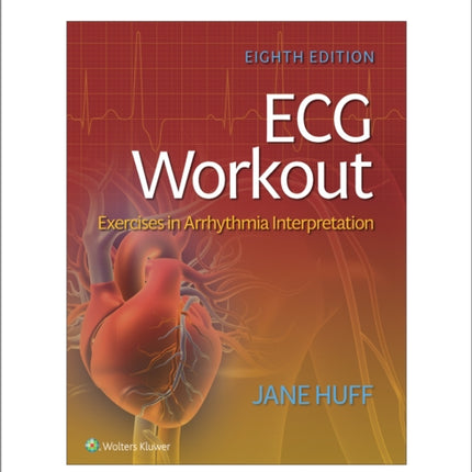 ECG Workout: Exercises in Arrythmia Interpretation