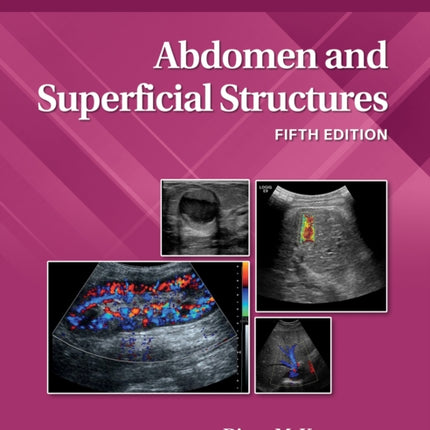 Abdomen and Superficial Structures