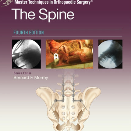 Master Techniques in Orthopaedic Surgery: The Spine