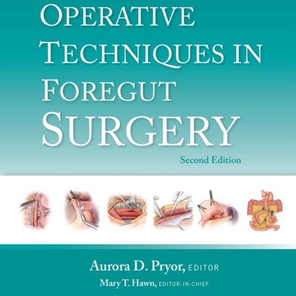 Operative Techniques in Foregut Surgery