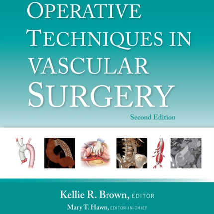 Operative Techniques in Vascular Surgery