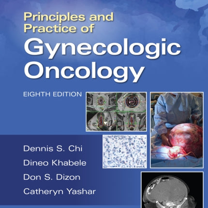 Principles and Practice of Gynecologic Oncology