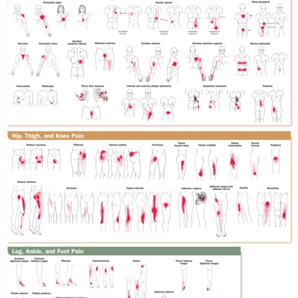 Travell, Simons & Simons’ Trigger Point Pain Patterns Wall Chart: Trunk, Pelvis, and Lower Limb