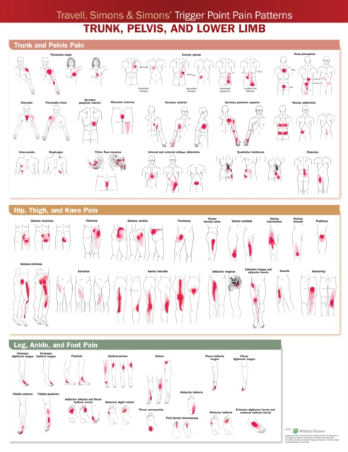 Travell, Simons & Simons’ Trigger Point Pain Patterns Wall Chart: Trunk, Pelvis, and Lower Limb