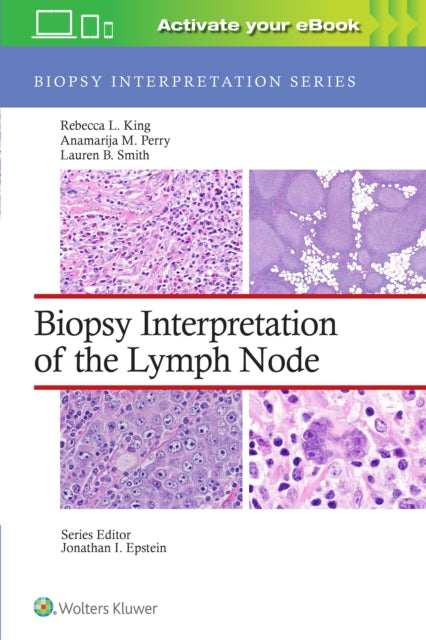 Biopsy Interpretation of the Lymph Node