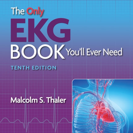 The Only EKG Book You’ll Ever Need