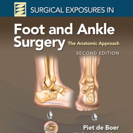 Surgical Exposures in Foot and Ankle Surgery: The Anatomic Approach