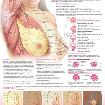 Understanding Breast Cancer Anatomical Chart