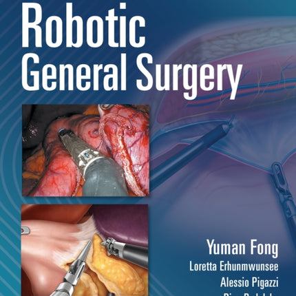 Robotic General Surgery