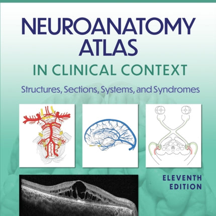 Neuroanatomy Atlas in Clinical Context
