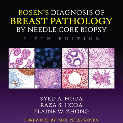 Rosen's Diagnosis of Breast Pathology by Needle Core Biopsy