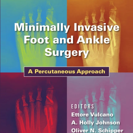 Minimally Invasive Foot and Ankle Surgery: A Percutaneous Approach