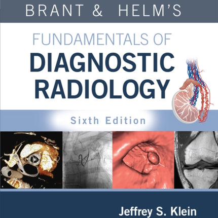 Brant  Helms Fundamentals of Diagnostic Radiology Print  eBook with Multimedia