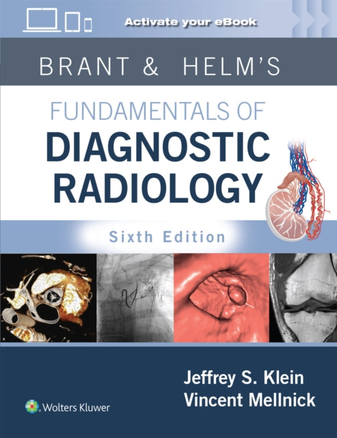 Brant  Helms Fundamentals of Diagnostic Radiology Print  eBook with Multimedia