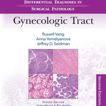 Differential Diagnoses in Surgical Pathology: Gynecologic Tract