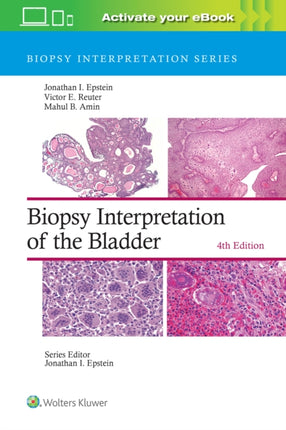 Biopsy Interpretation of the Bladder